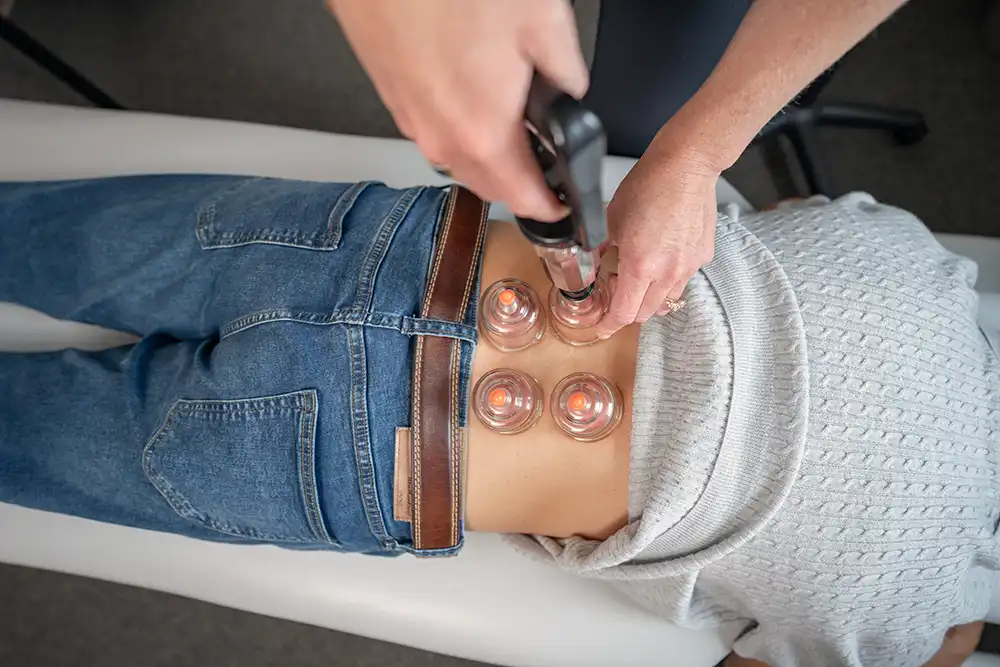 Cupping